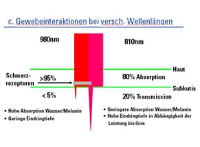 zimmer-opton-pro-3